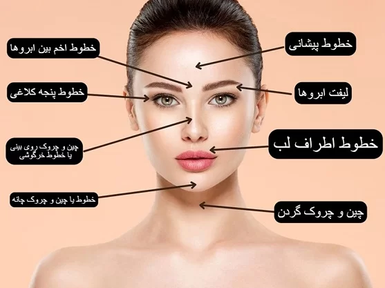 رازهای بوتاکس: چطور یک تزریق بی‌نقص داشته باشیم؟