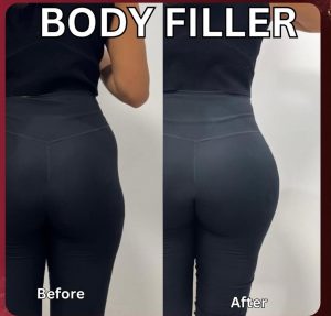 فیلر بادی هیپ هیپ