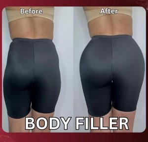 فیلر بادی هیپ هیپ