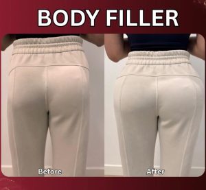 فیلر بادی هیپ هیپ