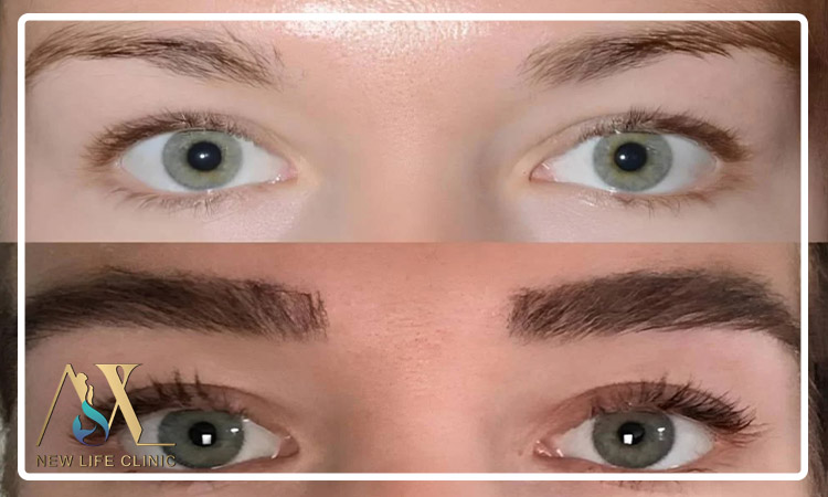 دوام کاشت ابرو طبیعی چقدر است؟