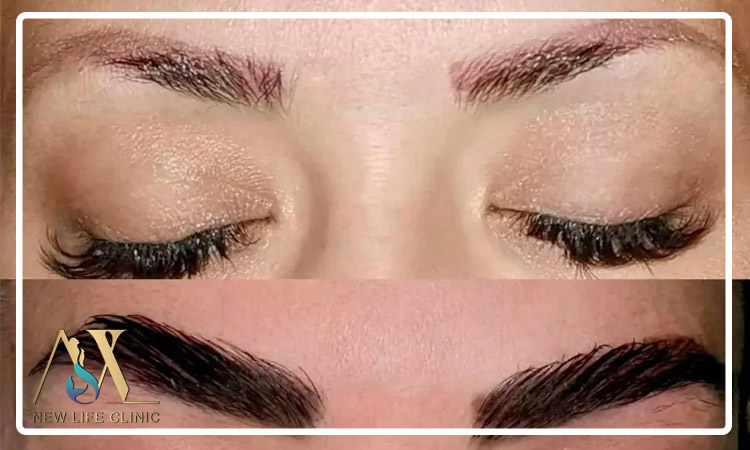 دوام کاشت ابرو طبیعی چقدر است؟
