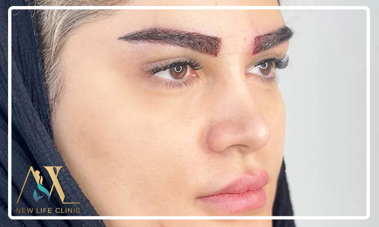 دوام کاشت ابرو طبیعی چقدر است؟