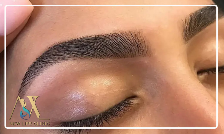 آیا کاشت ابرو طبیعی برای افرادی با پوست چرب مناسب است؟