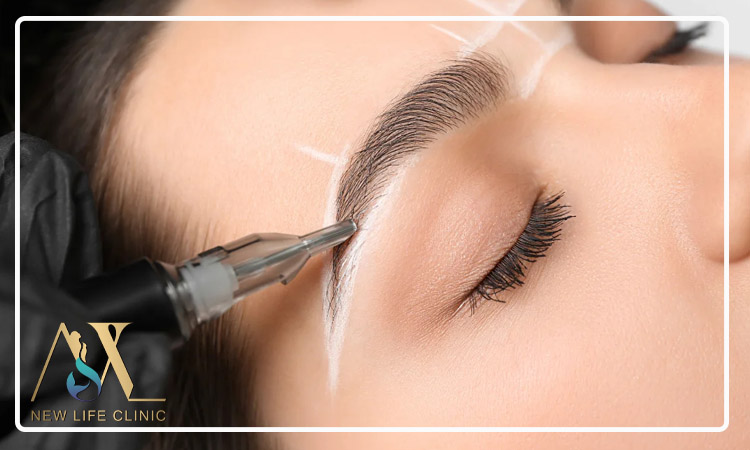 آیا کاشت ابرو طبیعی برای افرادی با پوست چرب مناسب است؟