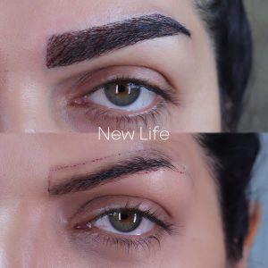 کاشت ابرو طبیعی