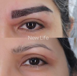 کاشت ابرو طبیعی