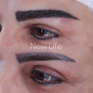 کاشت ابرو طبیعی