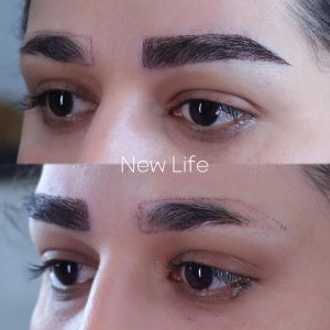 کاشت ابرو طبیعی