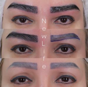 کاشت ابرو طبیعی