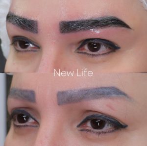 کاشت ابرو طبیعی