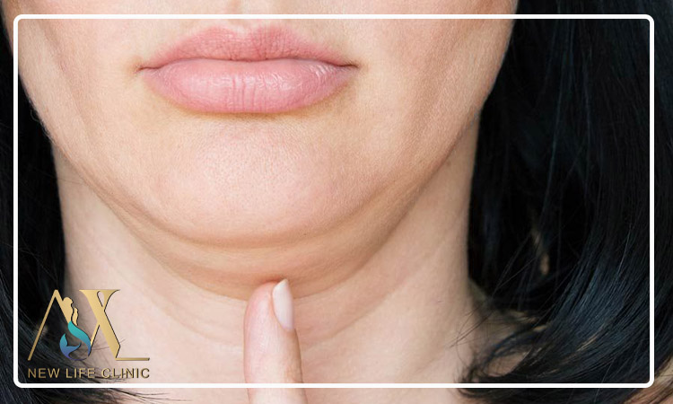 بهترین روش‌های لاغر شدن غبغب