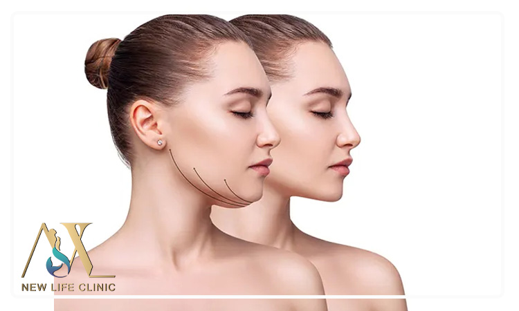 بهترین روش‌های لاغر شدن غبغب