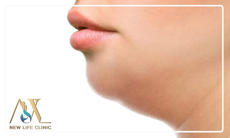 چرا با وجود لاغری هنوز غبغب دارم؟