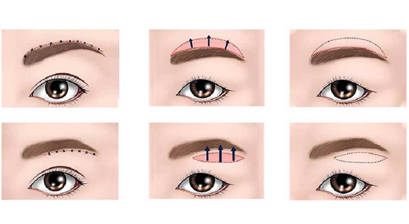 دایرکت ابرو