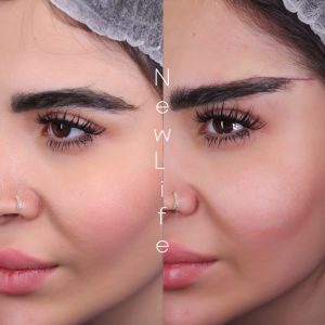 دایرکت ابرو