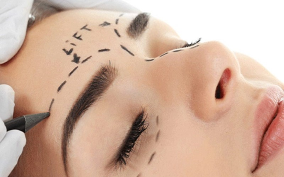 دایرکت ابرو