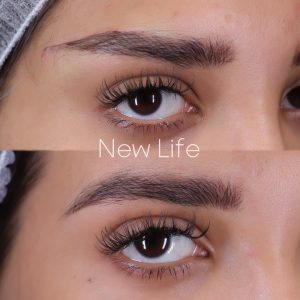 دایرکت ابرو