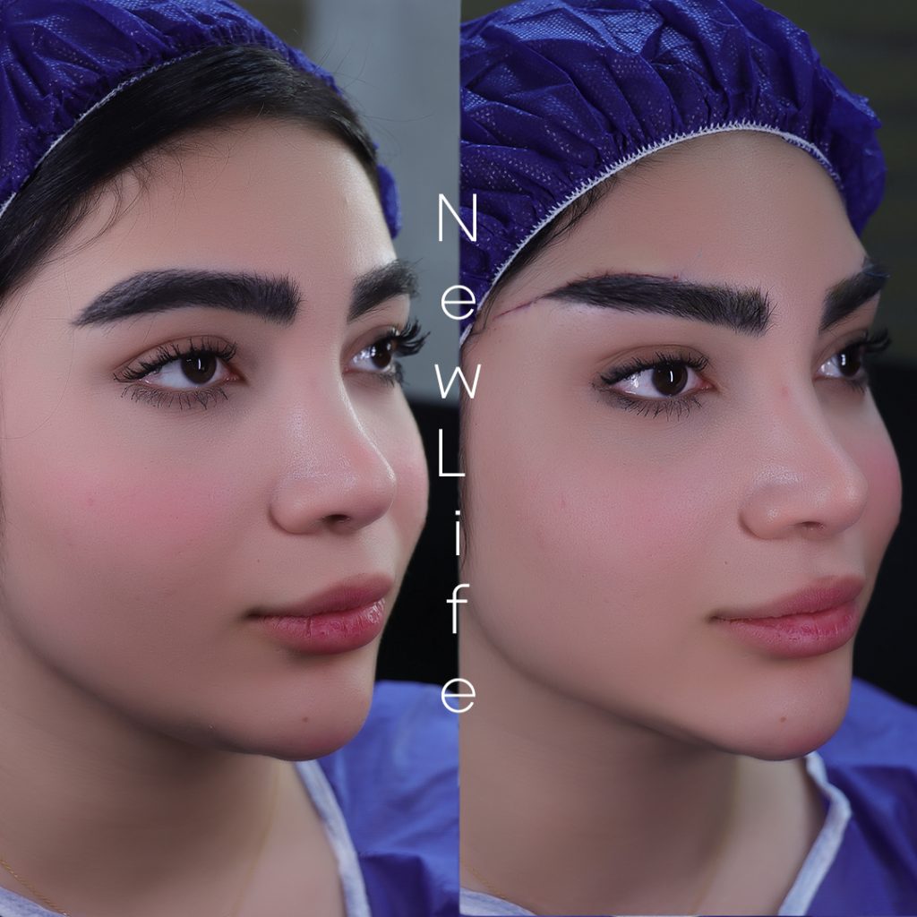 دایرکت ابرو