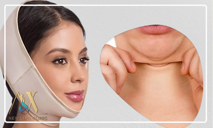 مدت دوران نقاهت لیپو فیس غبغب چقدر است؟