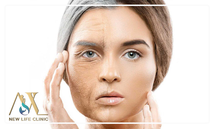 چند روز بعد از تزریق چربی صورت طبیعی می شود؟