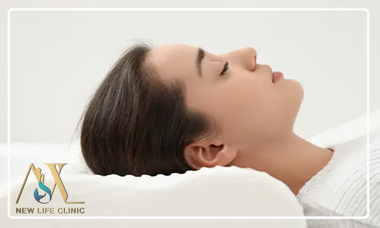 نحوه خوابیدن بعد از تزریق چربی صورت