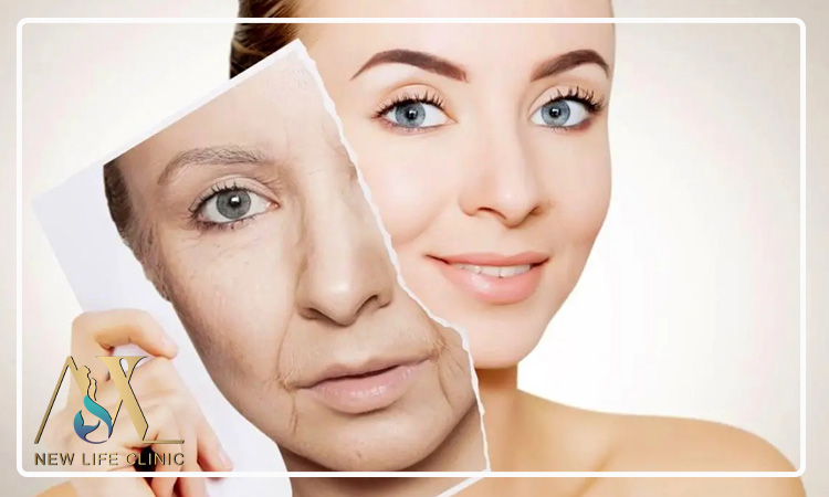 اثرات بلندمدت لیپو فیس بر زیبایی صورت