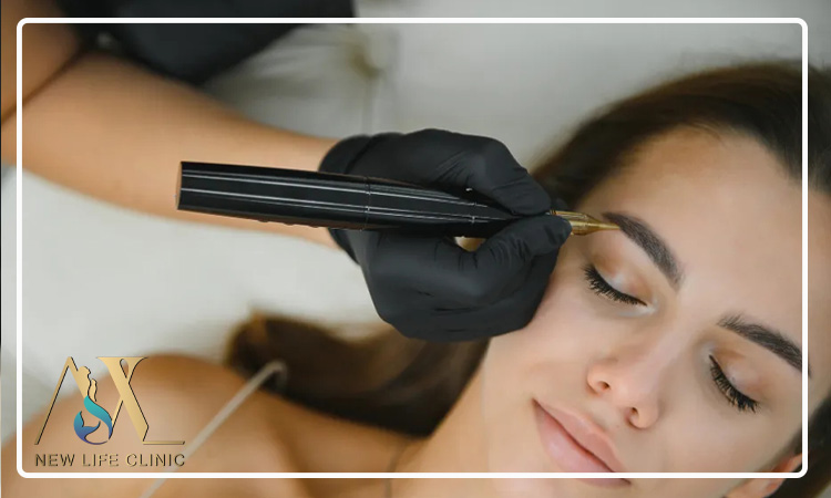 مزیت میکرو کاشت برای پر کردن ناحیه های خالی ابرو