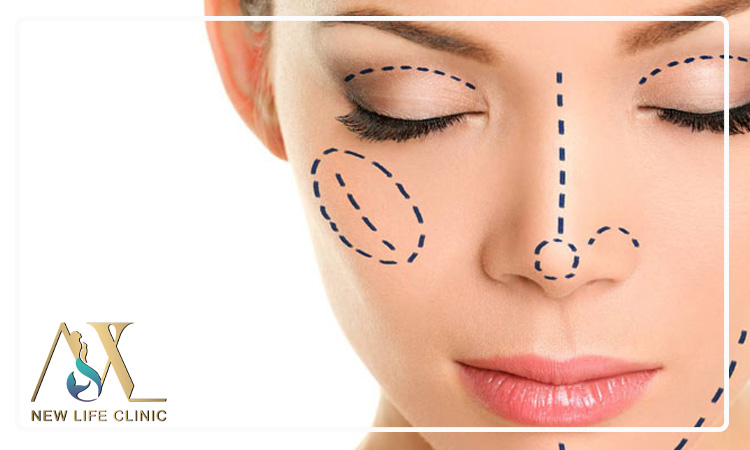 چه افرادی بهترین کاندید انجام لیپو فیس هستند؟