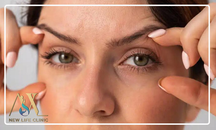 مقایسه بلفاروپلاستی با روش های غیر جراحی