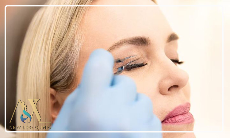 مقایسه بلفاروپلاستی با روش های غیر جراحی