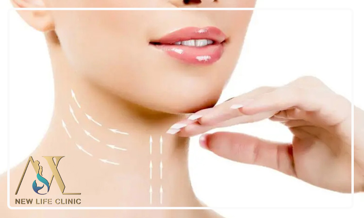 دوره نقاهت لیپو ساکشن غبغب چقدر طول می کشد؟